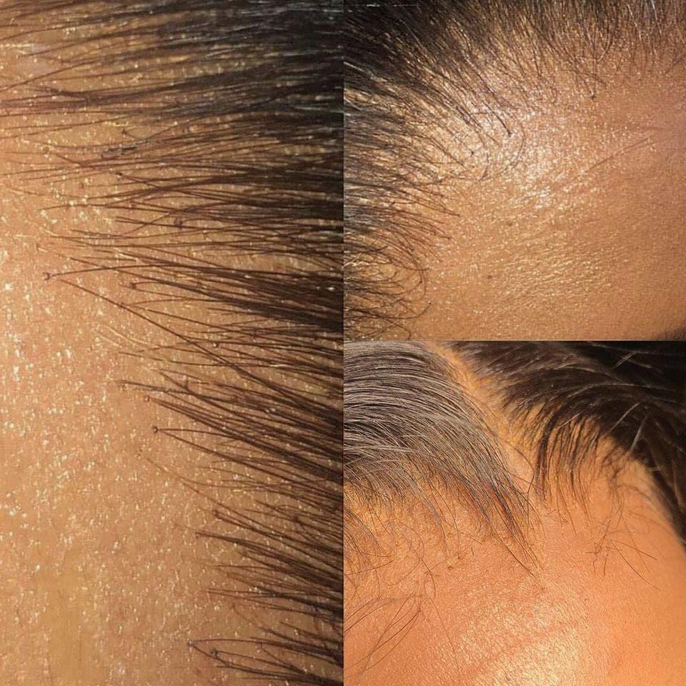 BAISI 4*4 HD Closure Perruque En 100% Cheveux Humains